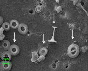 Coccolithophores come in all shapes and sizes